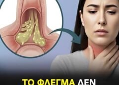 Πώς να ανακουφίσετε και να μειώσετε αποτελεσματικά και με ασφάλεια τα φλέγματα στον λαιμό Πώς να ανακουφίσετε και να μειώσετε αποτελεσματικά και με ασφάλεια τα φλέγματα στον λαιμό