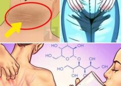 Αυτά είναι τα 8 σημάδια που δείχνουν ότι έχετε υπερβολική ζάχαρη στο σώμα σας